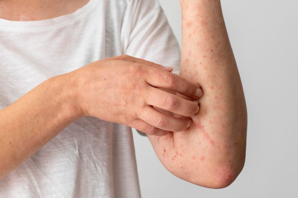 skin allergy reaction persons arm